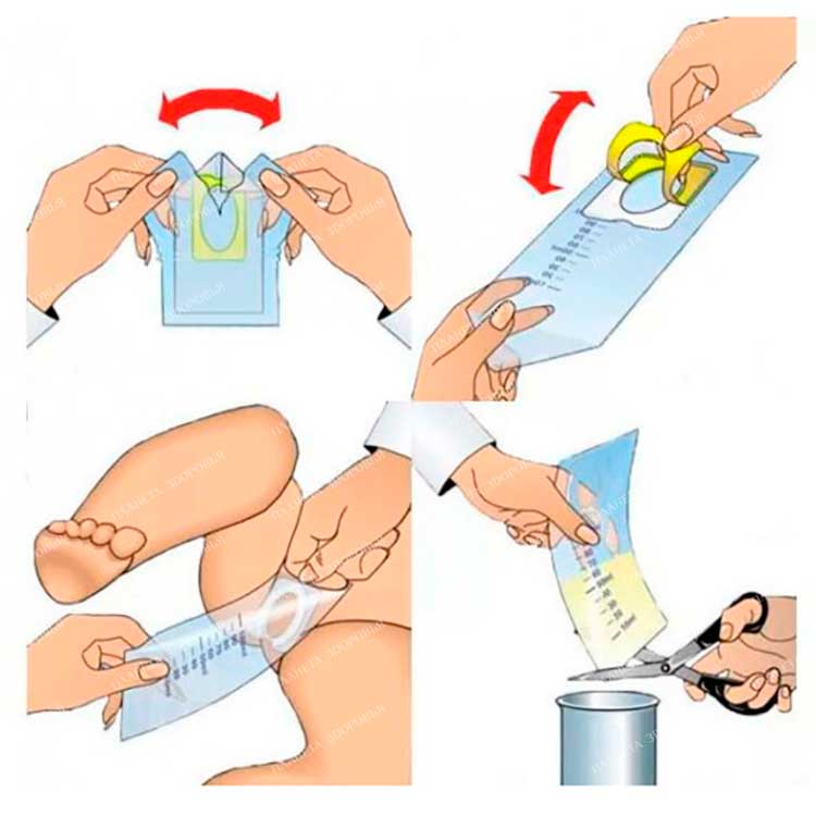 Инструкция по применению детского мочеприемника